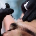 Role of Indian Skin Treatments for Dark Spots, Tan & Pigmentation Pre-Wedding